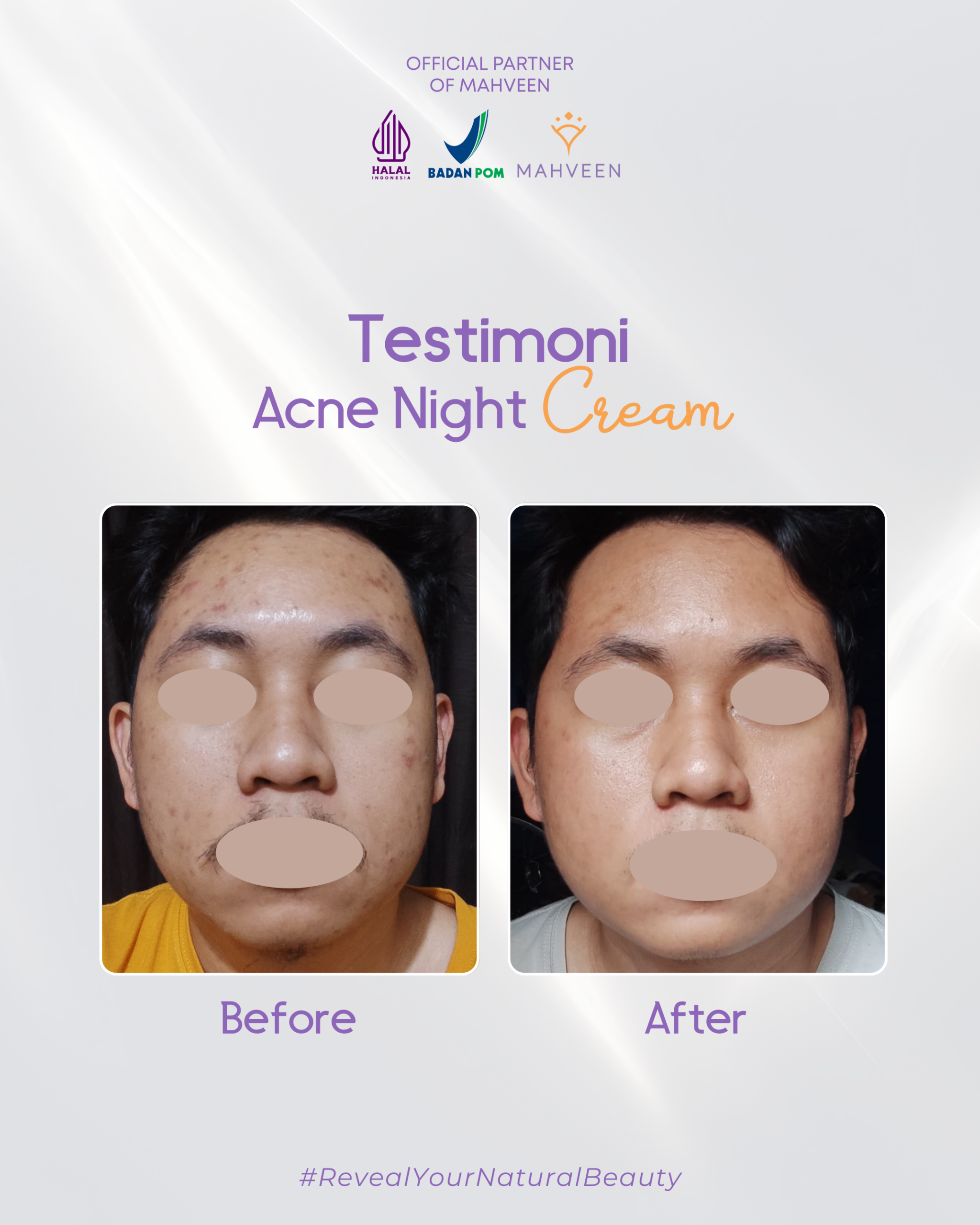 Slide 4 Acne Night Cream