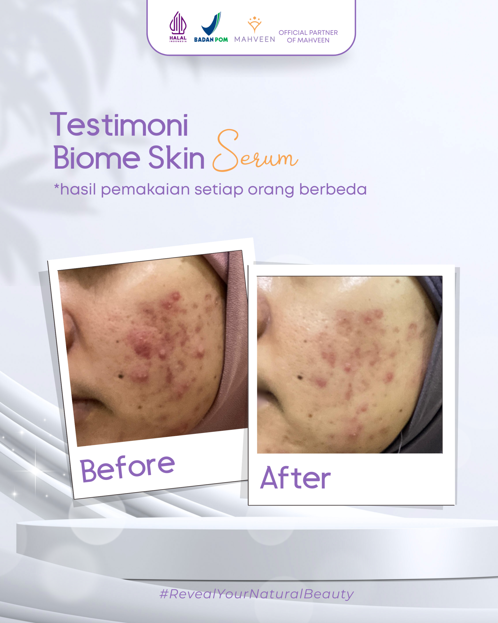 Slide 4 Biome Skin Serum