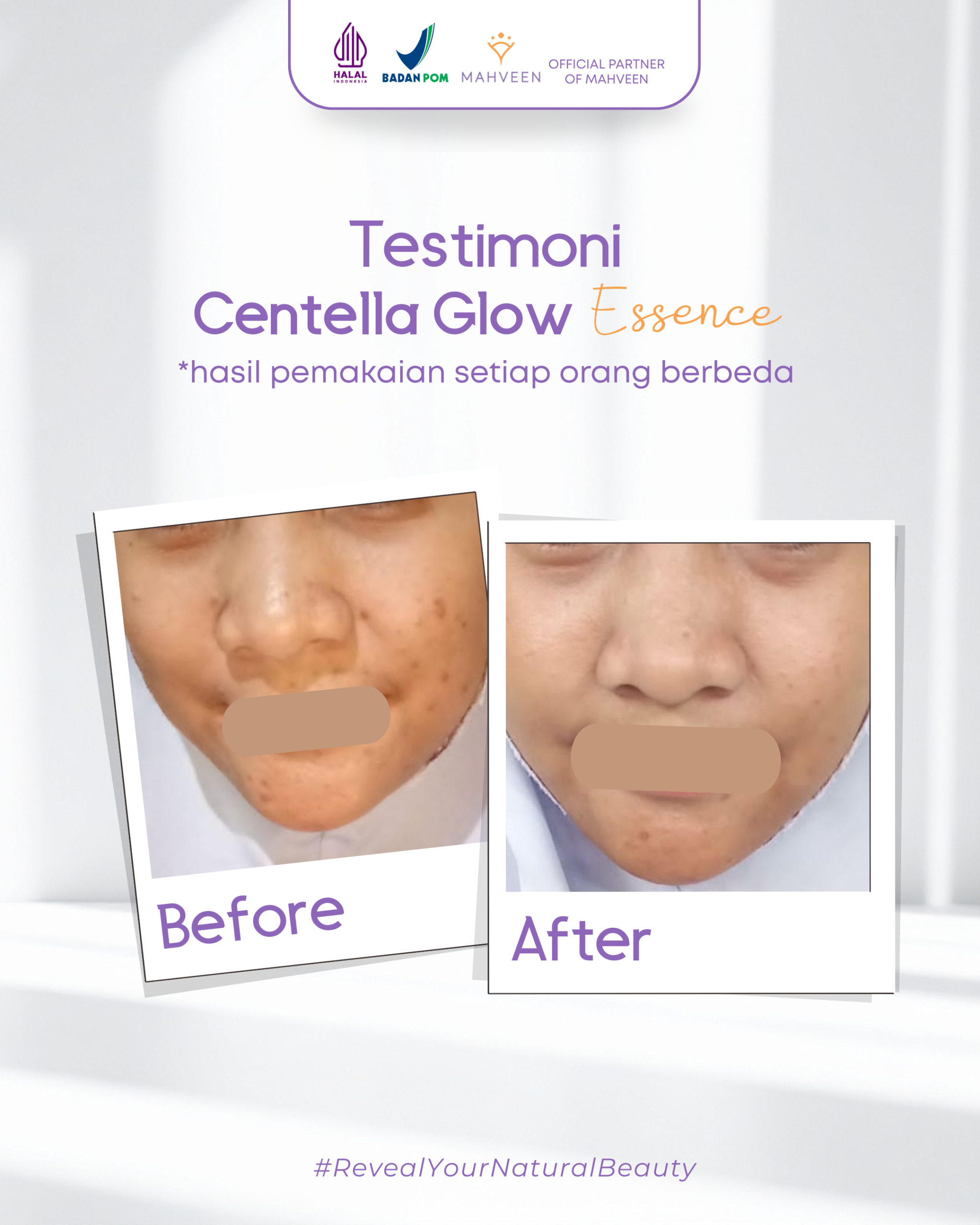 Slide 4 Centella Glow Essence