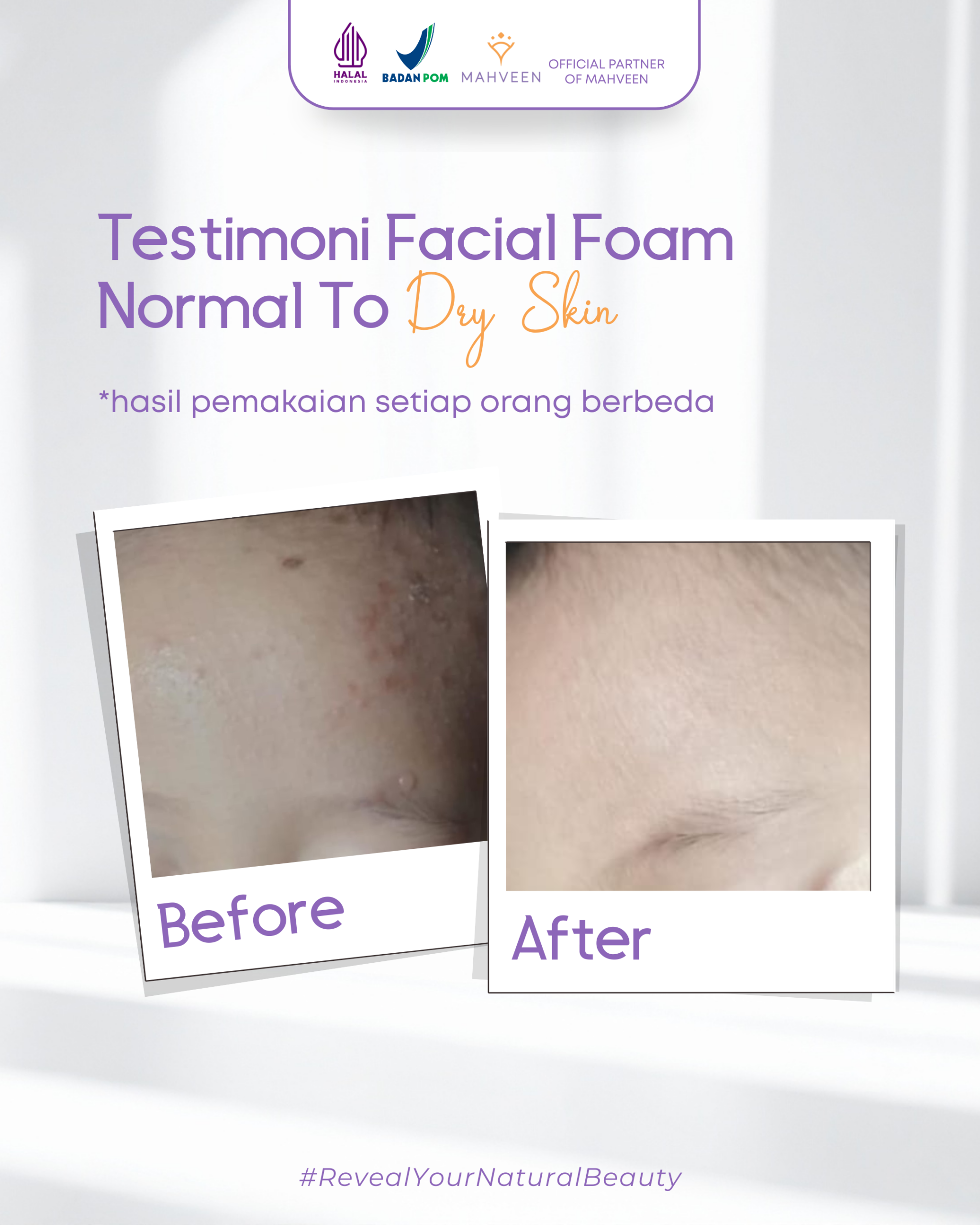 Slide 4 Facial Foam Normal To Dry