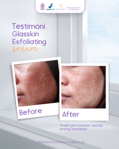Slide 4 Glasskin Exfoliating Serum