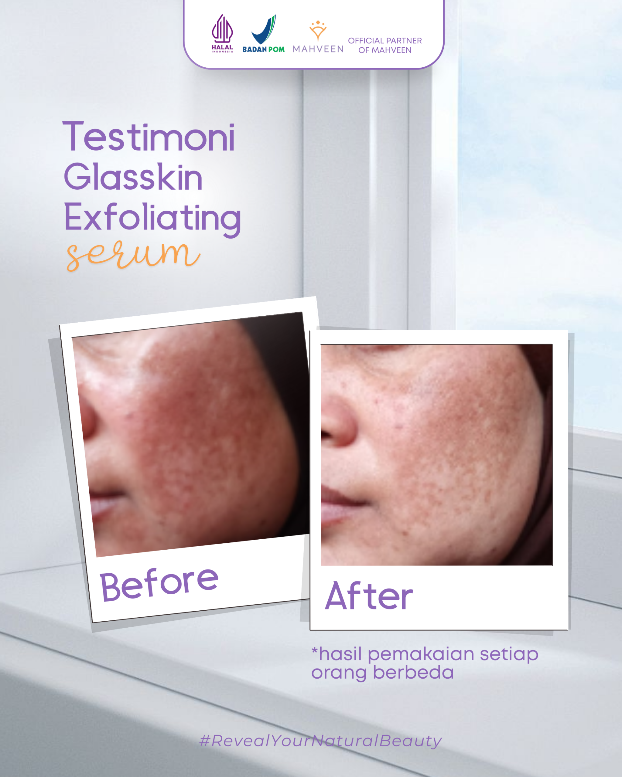 Slide 4 Glasskin Exfoliating Serum
