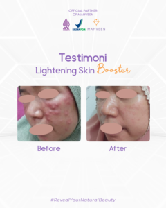 Slide 4 Lightening Skin Booster