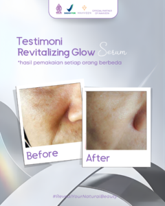 Slide 4 Revitalizing Glow Serum