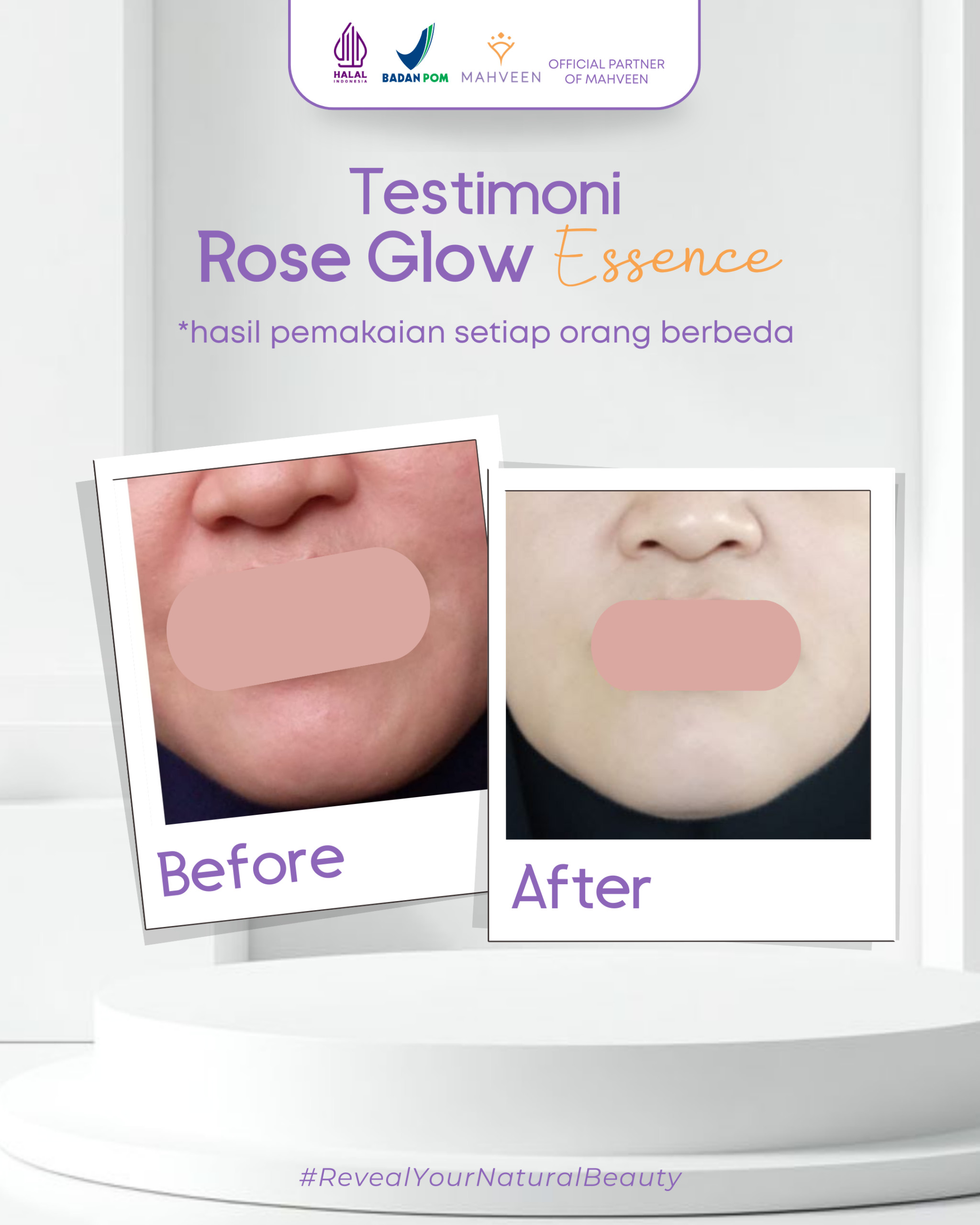 Slide 4 Rose Glow Essence