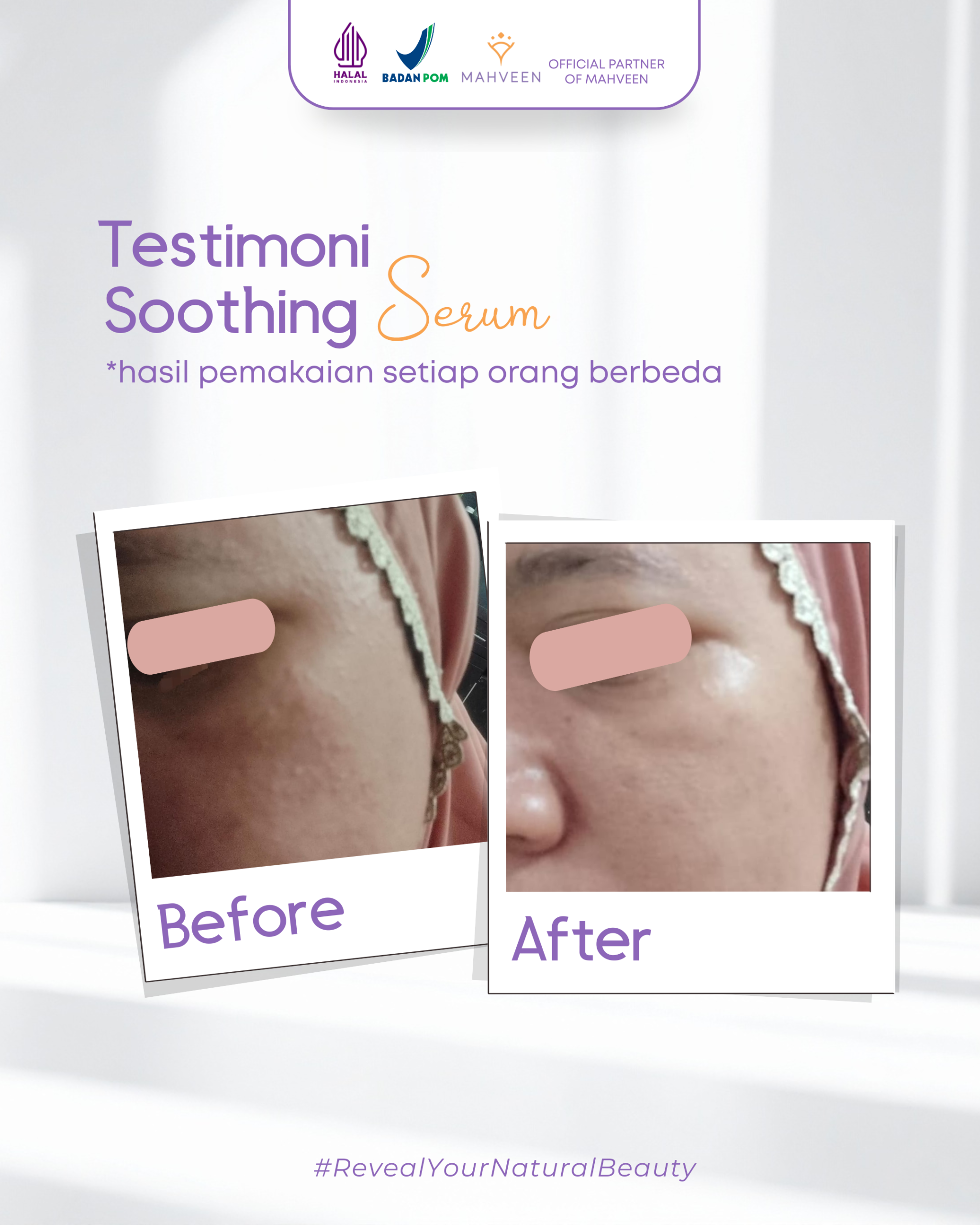 Slide 4 Soothing Serum